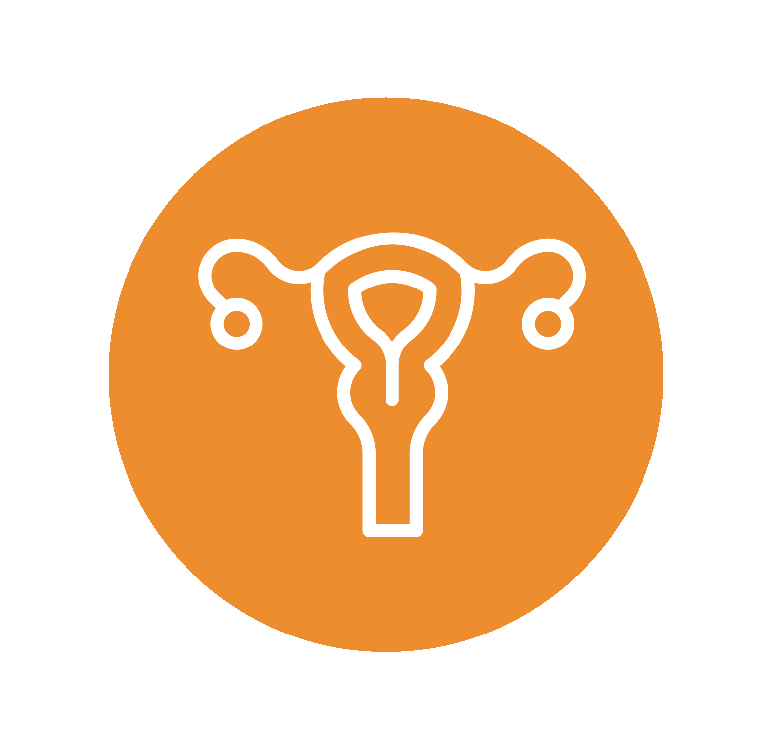Polycystic Ovary Syndrome